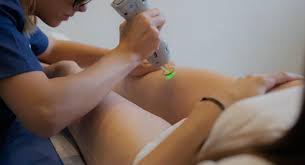 Who Should Consider Laser Hair Removal in Dubai?