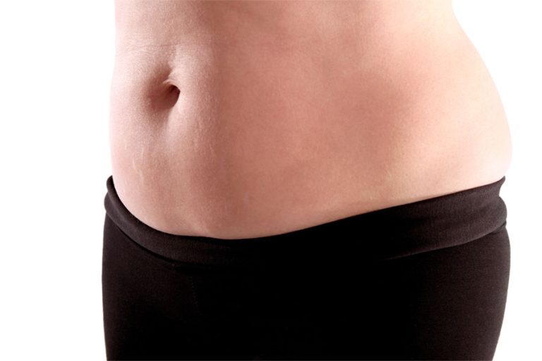 Trends in Laser Liposuction Pricing: What to Expect in Dubai UAE