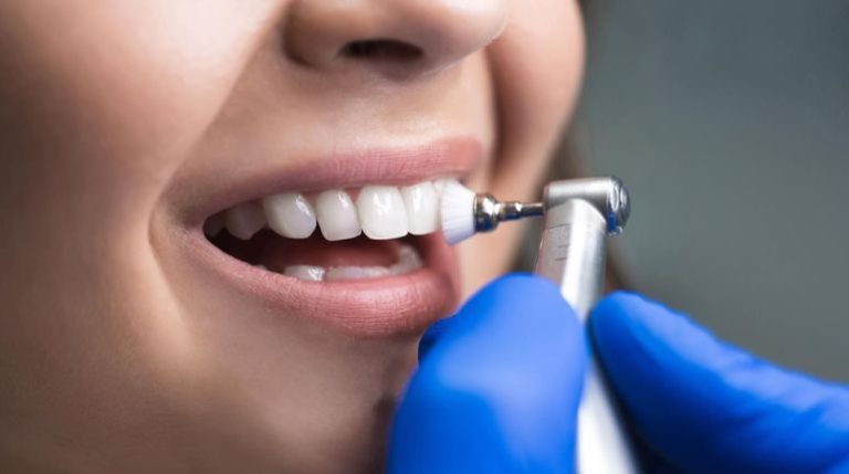 Why Regular Teeth Cleanings Are Vital for Oral Health