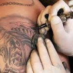 Be Ink Free Laser Tattoo Removal in Dubai