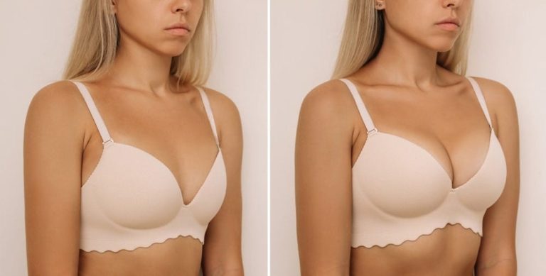 Non-Surgical Breast Augmentation Options in Dubai