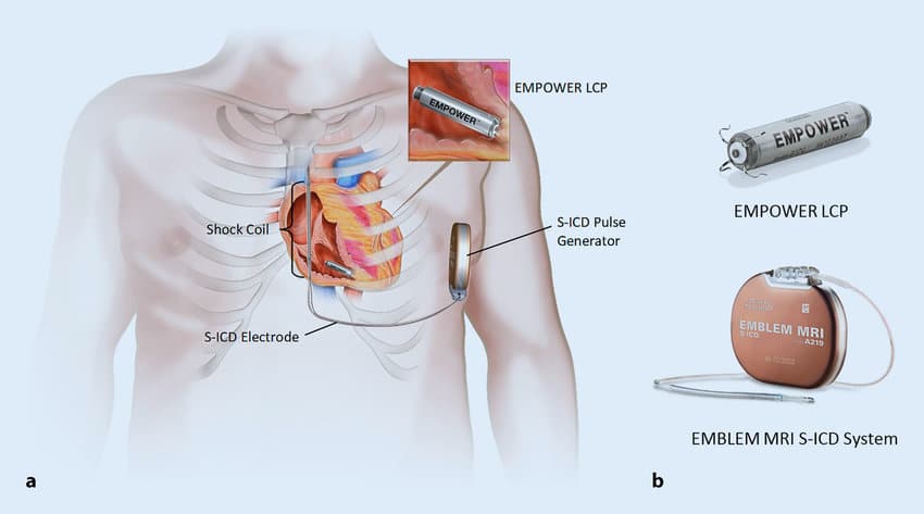 Cardiac Rhythm Management Devices Market Trends: Size and Share Analysis