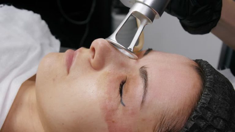 Best Clinic for Fractional CO2 Laser Treatment in Dubai