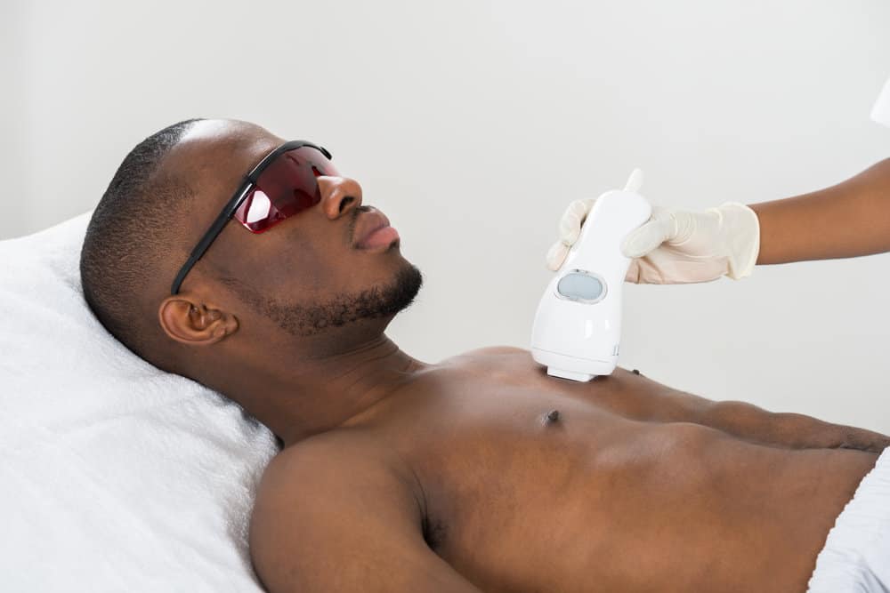 Laser Hair Removal