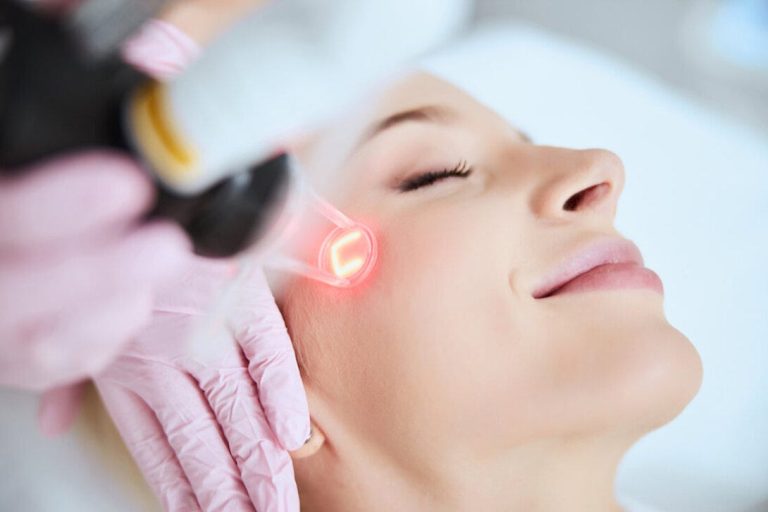 Fractional CO2 Laser Treatment: Top Questions Answered by Dubai Doctors