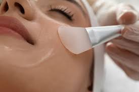 Dubai’s Best Chemical Peel Treatments