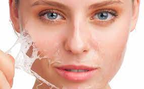 Improve Skin Texture with Chemical Peels Dubai