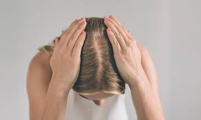 Help with Your Wife’s Hair Loss & Best Hair Solution in Dubai UAE