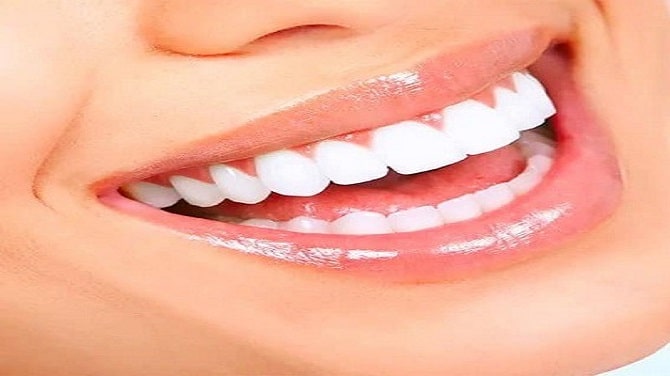 Highly Rated Teeth Whitening Services in Dubai