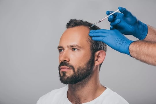 Best Hair Transplant Unlock Your Best Look