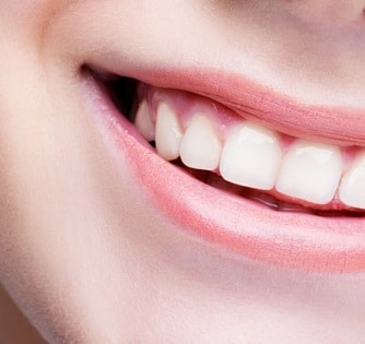 Teeth Whitening: Simple Steps for a Radiant Smile